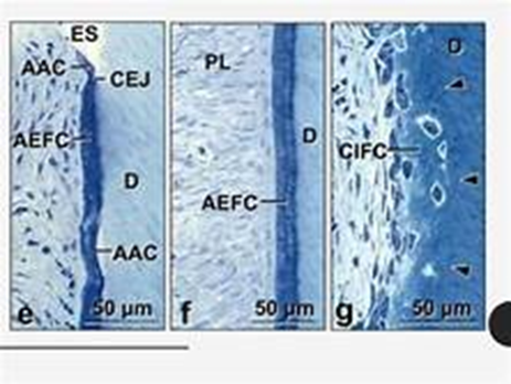 acellular cementum