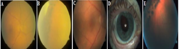 Fundus image