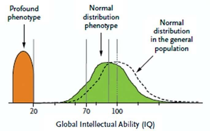 tuberous sclerosis