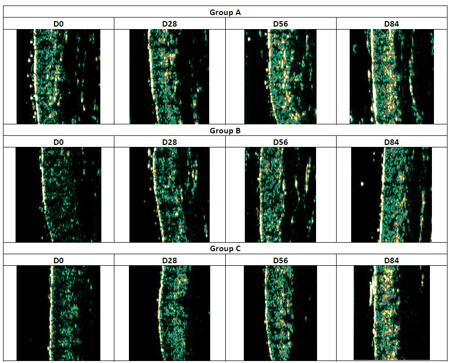 Ultrasonography images