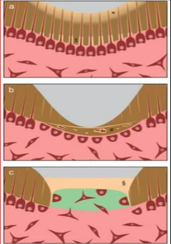 Regeneration and repair process in dentin