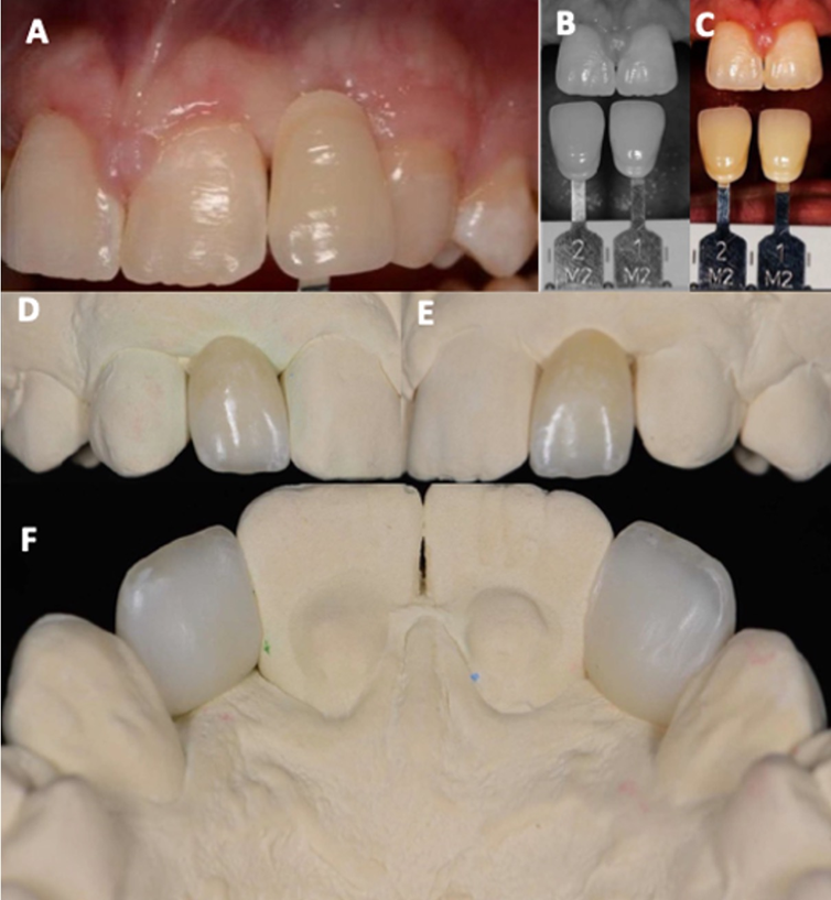 Intra-operative photograph