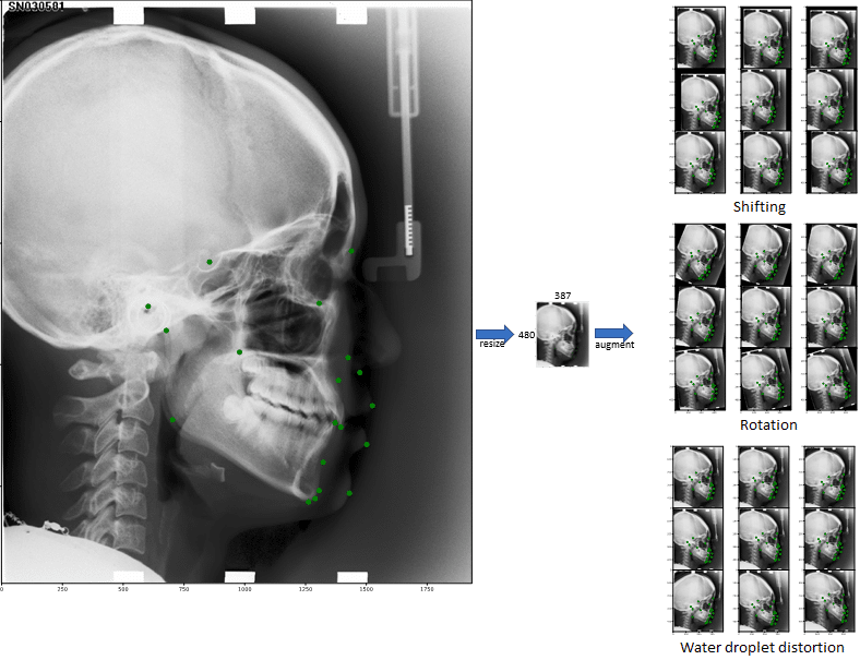 Locating Cephalometric Landmarks with Multi-Phase Deep Learning ...