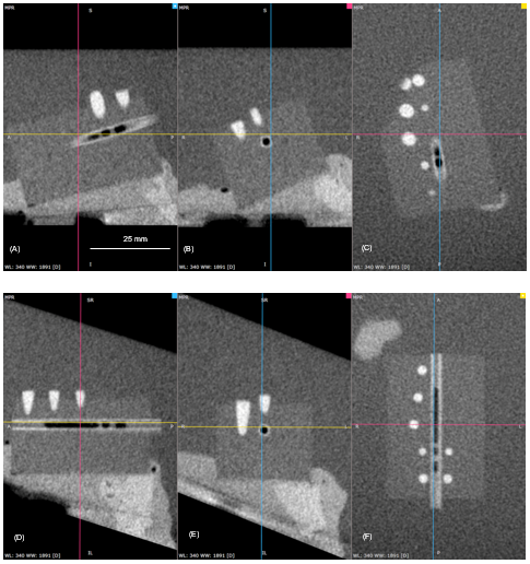 coronal and axial views