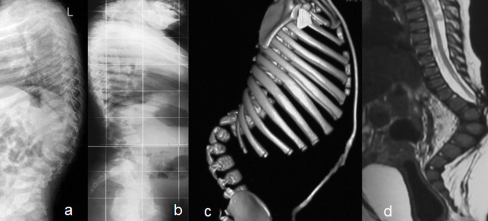 Lateral spine radiograph