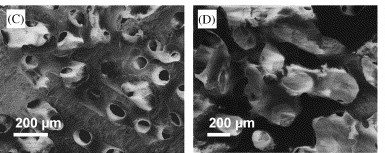 coralline hydroxyapatite bone scaffolds