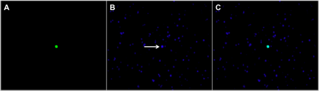 cells stained with bismenzimide