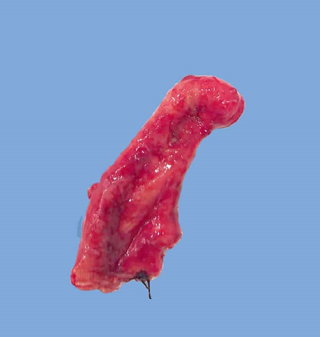 appendix