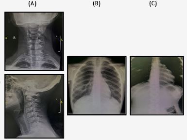 X-rays of Neck, chest, Abdomen