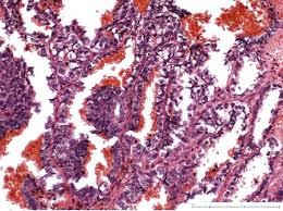 columnar epithelium