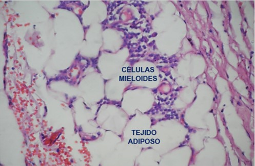 myeloid and adipose tissue