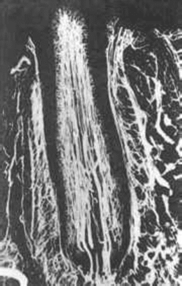 dental pulp