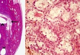 cuboidal epithelium